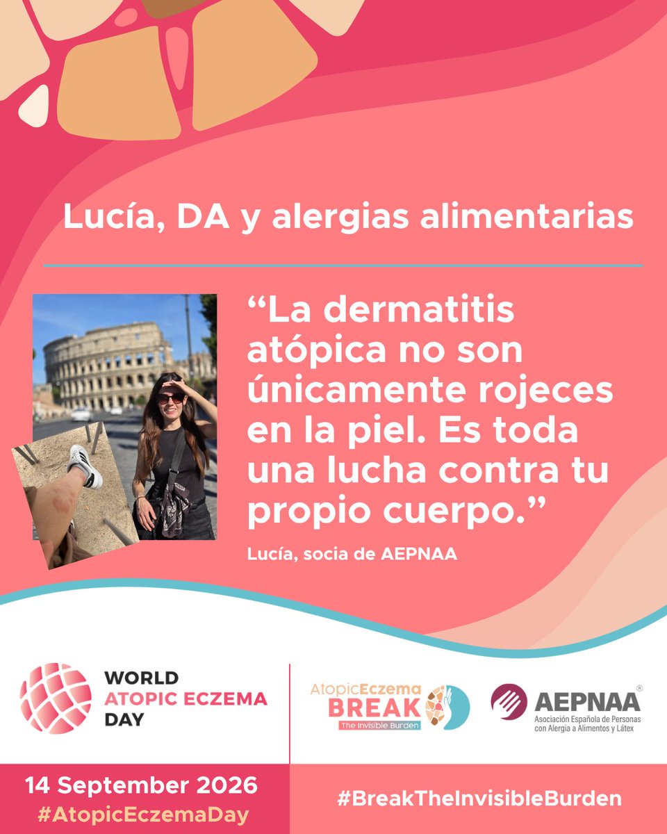 AEPNAA1's tweet photo. 🧡 No todo lo que pesa, se ve en la piel. Hoy, #DíaMundialDeLaDermatitisAtópica, nos sumamos a @EFA_Patients y #BreakTheInvisibleBurden.
Lucía convive con DA y alergias alimentarias: “Es toda una lucha contra tu propio cuerpo”.
👉 Recupera su historia: https://t.co/rpFlb1irbq https://t.co/MuA0AhNg9u