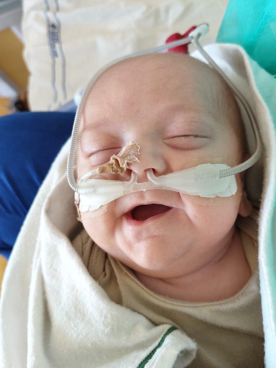RobertoGiuffre's tweet photo. @itsmeback_ La figlia (non vaccinata) di una mia amica è andata a fare un figlio con un vaccinato, nato prematuro è stato a lungo in terapia intensiva, ed anche se trasferito in pediatria continua ad essere a rischio.
Sta ancora in queste condizioni seguito a vista. https://t.co/0ta2JXjmrK