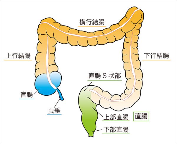 preventivenurse's tweet photo. 中村ゆりさん、ご冥福をお祈り申し上げます。

直腸がんは、大腸のいちばん肛門に近い「直腸」にできるがんです。大腸がんの一種で、初期にはほとんど症状がないこともあります。

代表的な症状は、便に血が混じる・便が細くなる・便秘と下痢を繰り返す・残便感・腹痛・貧血・体重減少などです。ただし「痔だと思っていたら直腸がんだった」というケースもあるため、血便が続く場合は注意が必要です。

診断には主に大腸内視鏡検査を行い、疑わしい部分の組織を採取して確定します。さらにCTやMRIで、がんの深さやリンパ節・他臓器への転移を調べます。

治療は進行度によって異なり、早期なら内視鏡で切除できる場合があります。進行すると手術、抗がん剤、放射線治療などを組み合わせます。直腸は肛門に近いため、がんの位置によっては「肛門を残せるか」が治療の重要なポイントになります。

特に血便が繰り返す、便の形が急に変わった、原因不明の貧血がある場合は、一度消化器内科で相談することが大切です。
