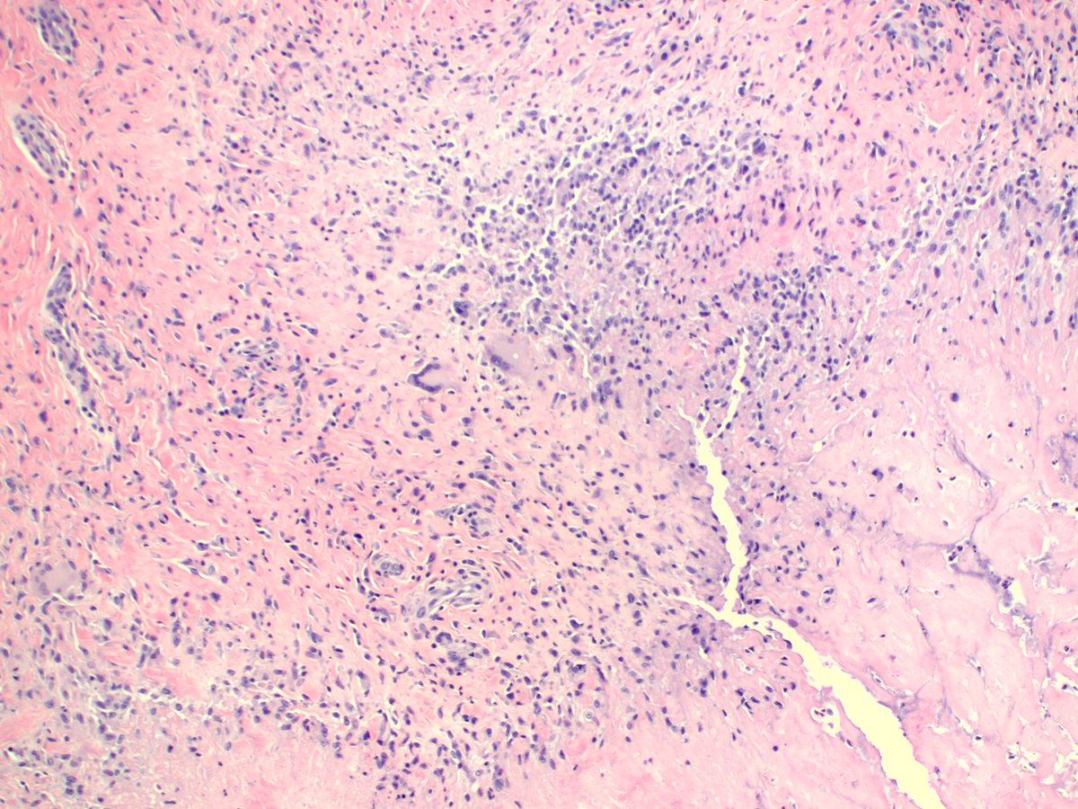 pathothama tweet picture