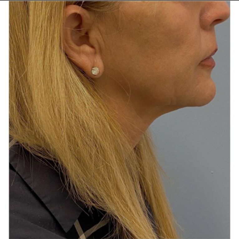 nmoaksom's tweet photo. Post-Summer Skin Reset: Our Top 3 Treatments - https://t.co/1jxcYjO5IQ https://t.co/buJEAMyDNJ