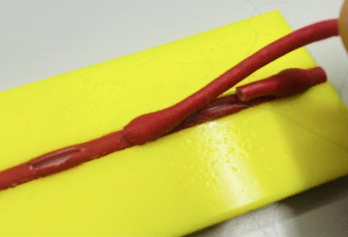 taito_877's tweet photo. A coronary anastomosis a day while working https://t.co/viy4jKJM9k