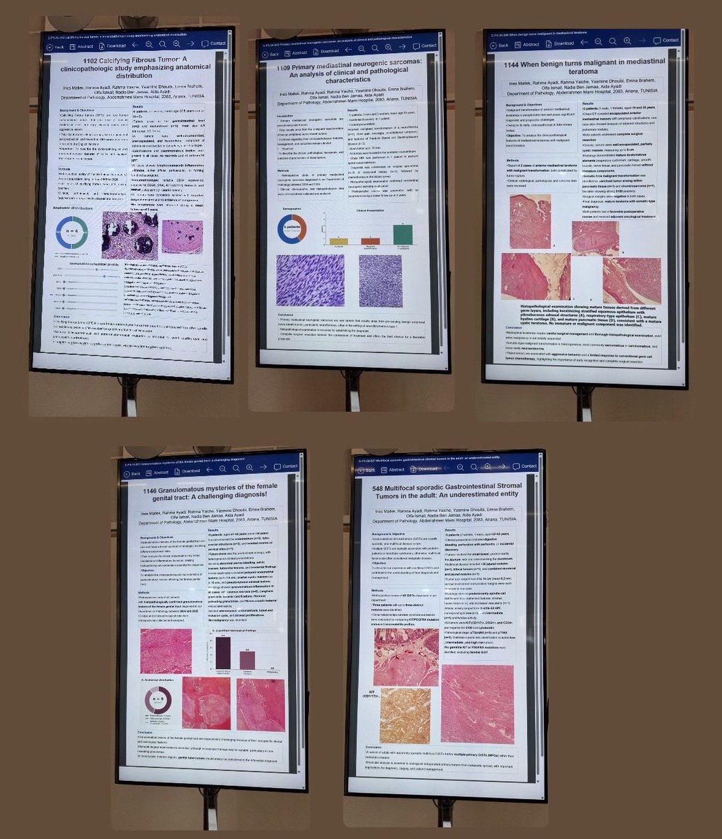 Ines_MALLEK's tweet photo. Proud to present 5 e-posters on rare entities at #ECP2026 🇸🇪🔬

📌 Calcifying fibrous tumors
📌 Granulomatous lesions of the female genital tract
📌 Multifocal sporadic GISTs
📌 Primary mediastinal neurogenic sarcomas
📌 Malignant transformation in mediastinal teratomas https://t.co/BvklEhqqlY