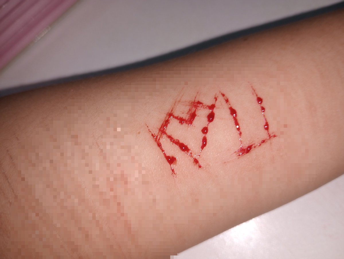 minishoujo's tweet photo. hillu... guys, i love you! this is just sfx makeup :3 #shtwt https://t.co/D2nrXr2frG