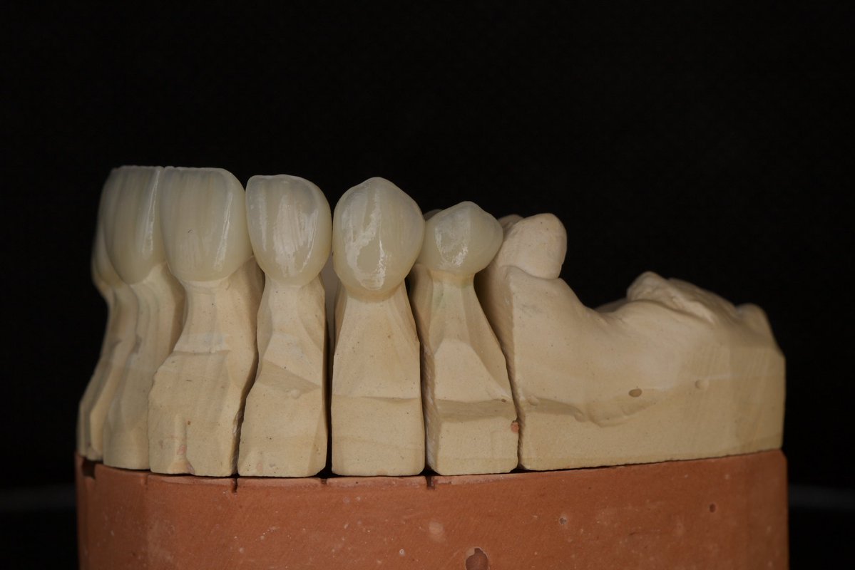 NfwUf's tweet photo. Another case wrapped up. 🦷
#FlowDent https://t.co/8V2uxNb6tx