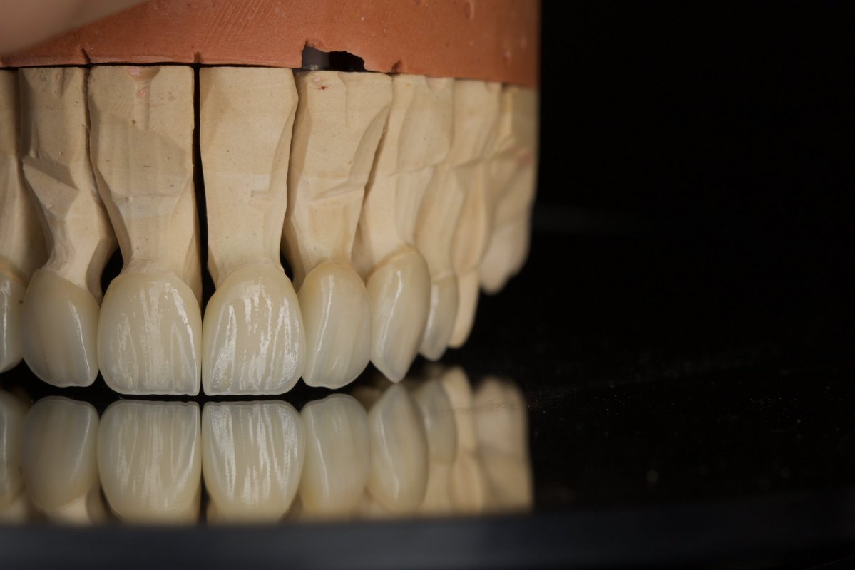 NfwUf's tweet photo. Another case wrapped up. 🦷
#FlowDent https://t.co/8V2uxNb6tx