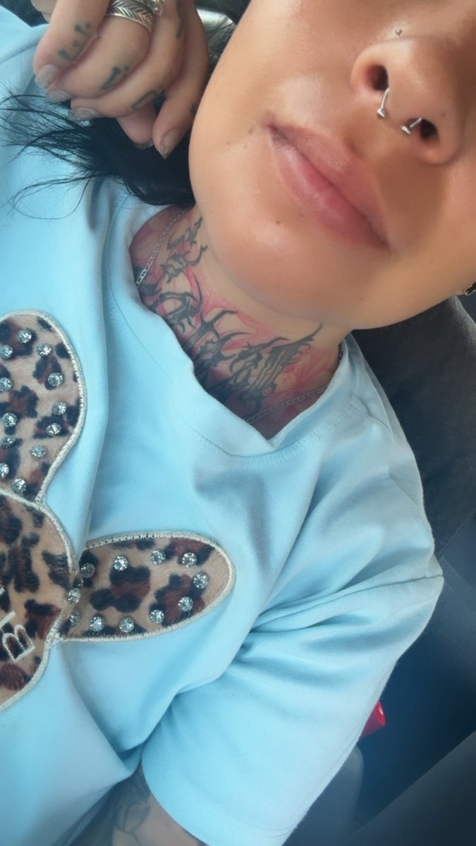 Carolinatovp's tweet photo. Muy buenos días babys!
Pues seguimos en recuperación todavía con un poco de dolor e inflamación pero ya mucho mejor . 
Gracias a los que han estado preguntando ya pronto estaré de vuelta con buenos descuentos para ustedes ❤️ https://t.co/mCYbeU9qMg