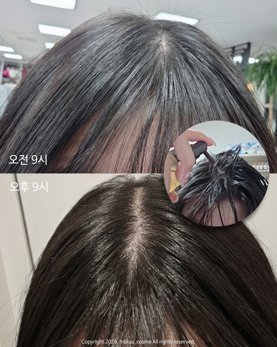 mbluu_cosme's tweet photo. #협찬  #RT이벤트 

 ✨️#RT+ @levero_official 팔로우 5명 추첨 르베로 헤어토닉 드려요(당발9/18)✨️

제가 며칠전에 두피 개선+모발 개선에 효과 봤다구한 제품!

〰️맥주효모수 69%고함량 베이스
〰️4종 펩타이드+6종식물성 단백질
〰️자연유래 성분으로 두피 유수분밸런스케어
〰️엘-멘톨, 박하 추출물로 산뜻한 마무리
〰️플라워 가든 같은 은은한 생화향

르베로 두피 브러쉬로 샴푸하고 >> 타올 드라이만 한 모공 열린 상태에서 두피에 골고루 뿌려주기>>손가락으로 톡톡 마사지해서 흡수

이렇게만 아침에 하면 하루종일 보송보송 쾌적한 두피를 가질 수 있음✨️ 매일매일 꾸준히 사용하면 확실히 두피가 개선된게 느껴지고 머리카락 빠짐도 덜해짐!
헤어 토닉 추가로 하루가 달라진다.. 심지어 1만원대라서 가성비 미침💦다들 르베로 헤어토닉 하세요🫶
