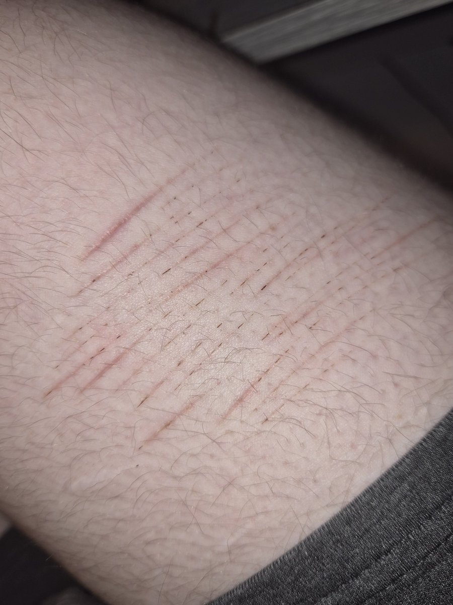 VoiidsDecay's tweet photo. basically fully healed https://t.co/fcihVTNEPu