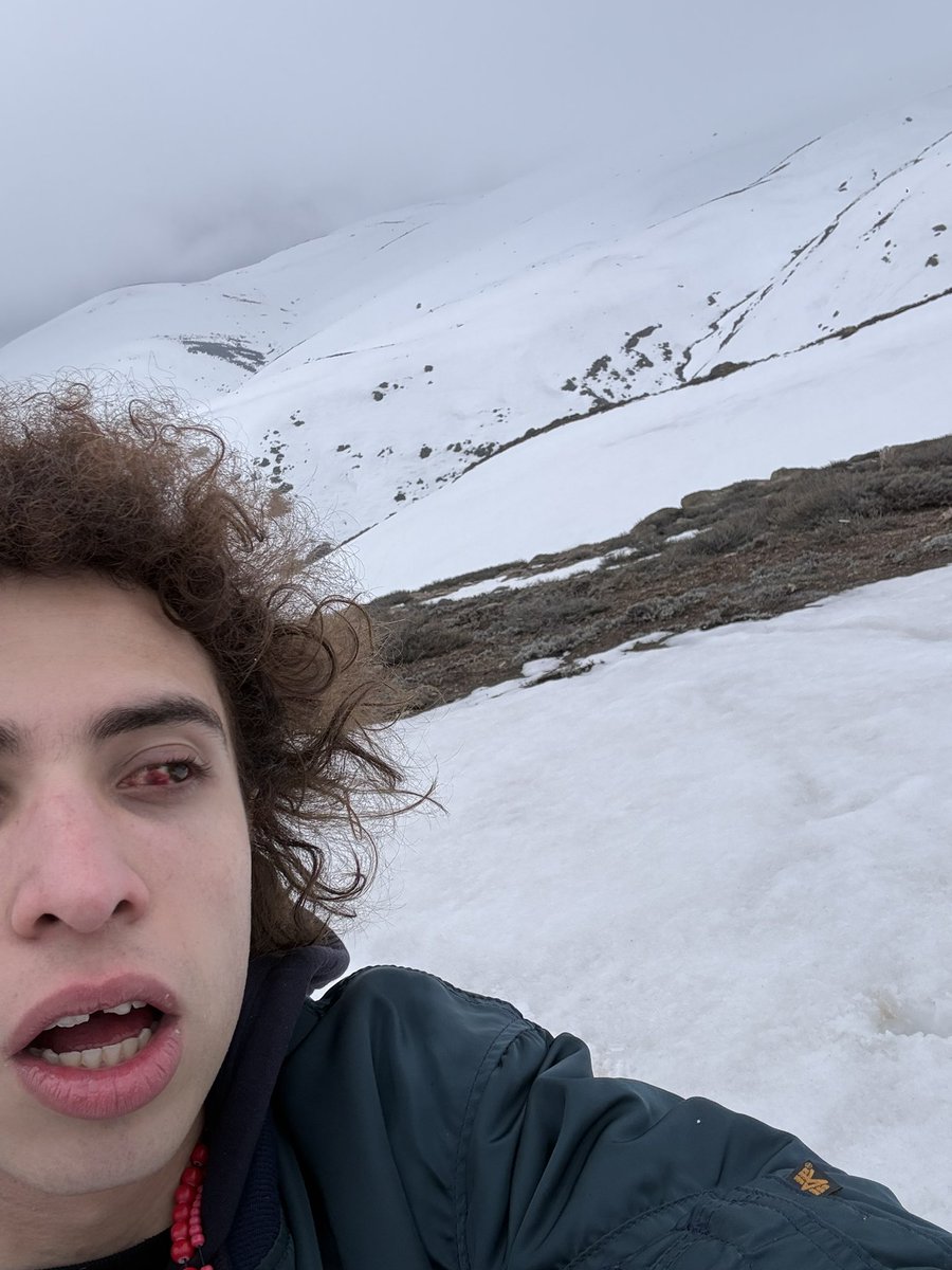 ceroasterisco's tweet photo. my eye broke. https://t.co/VlIqnXEz52