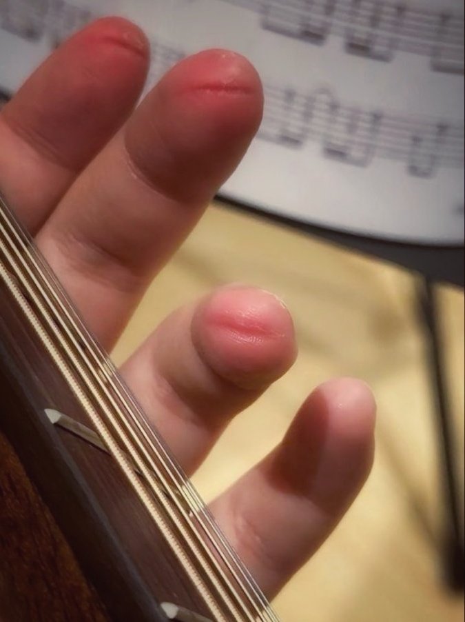 REXVOIRE's tweet photo. Calluses. Some scars are earned. https://t.co/tWIBmnwxwJ