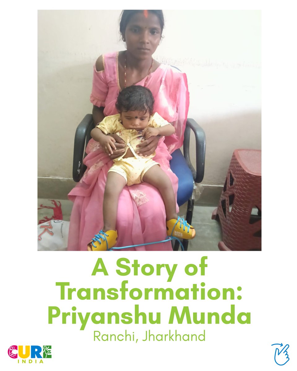 clubfootindia's tweet photo. Small Steps, Big Victory!
Priyanshu Munda from Ranchi fought atypical #clubfoot with help from RIMS Ranchi & #CUREIndia.
Free tenotomy + braces = wonderful correction! Thankful for his parents' trust.
Free treatment available; come forward today!
#RIMSRanchi #FreeTreatment https://t.co/m7ytD5PN9G