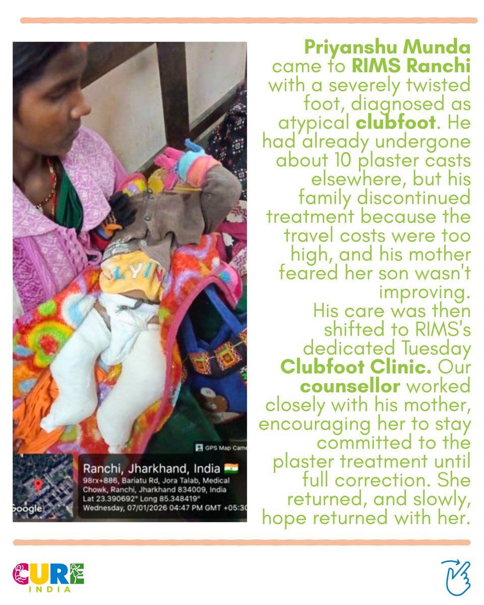 clubfootindia's tweet photo. Small Steps, Big Victory!
Priyanshu Munda from Ranchi fought atypical #clubfoot with help from RIMS Ranchi & #CUREIndia.
Free tenotomy + braces = wonderful correction! Thankful for his parents' trust.
Free treatment available; come forward today!
#RIMSRanchi #FreeTreatment https://t.co/m7ytD5PN9G