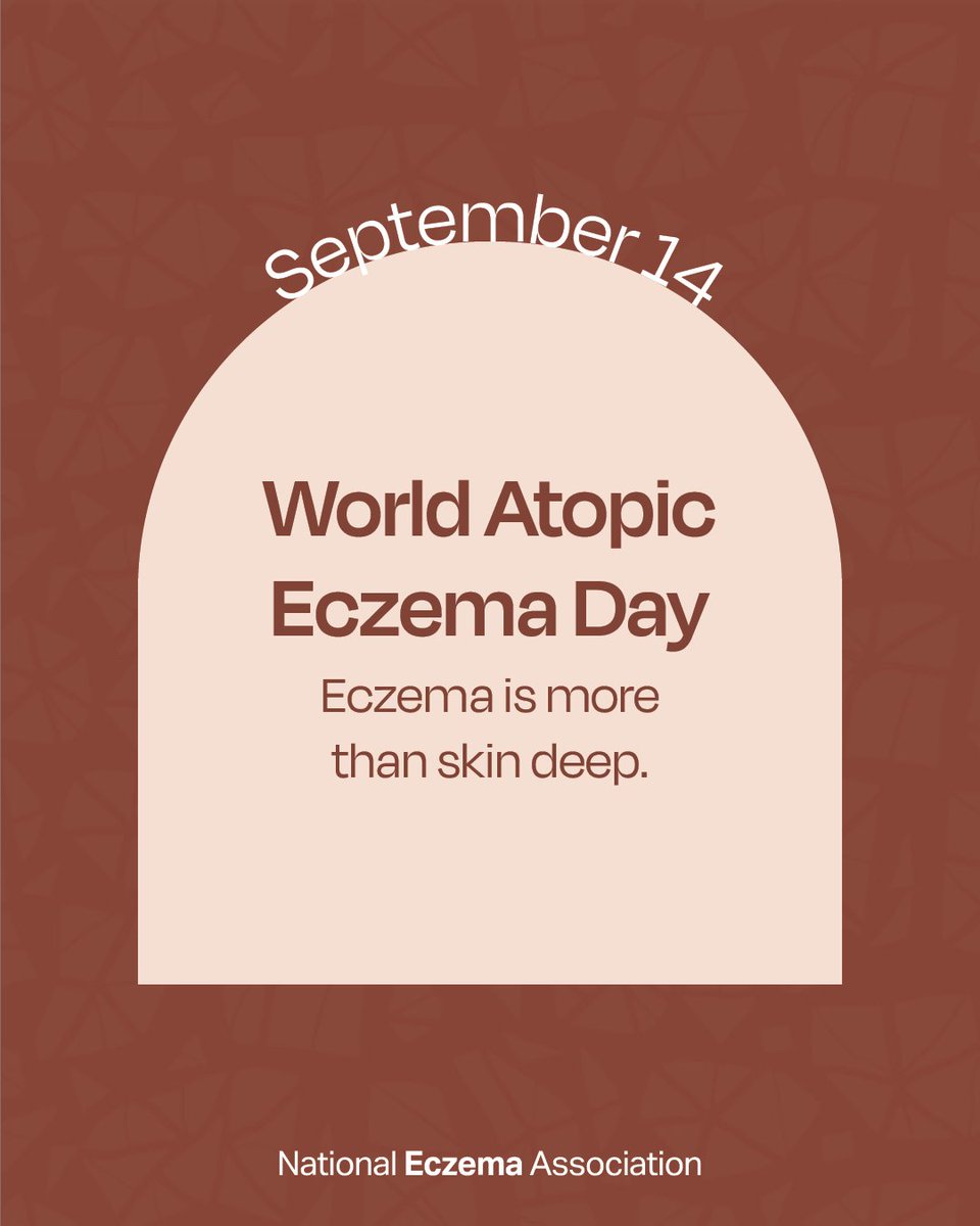nationaleczema's tweet photo. 230 million people, 31+ million in the U.S. have #eczema. This #WorldAtopicEczemaDay, NEA stands behind #BreakTheInvisibleBurden — by supporting legislation, research funding &amp; policy that reflects what people experience. What's seen and what isn't. 🔗 https://t.co/rihGI0OcPa https://t.co/Tis9CLRS2d