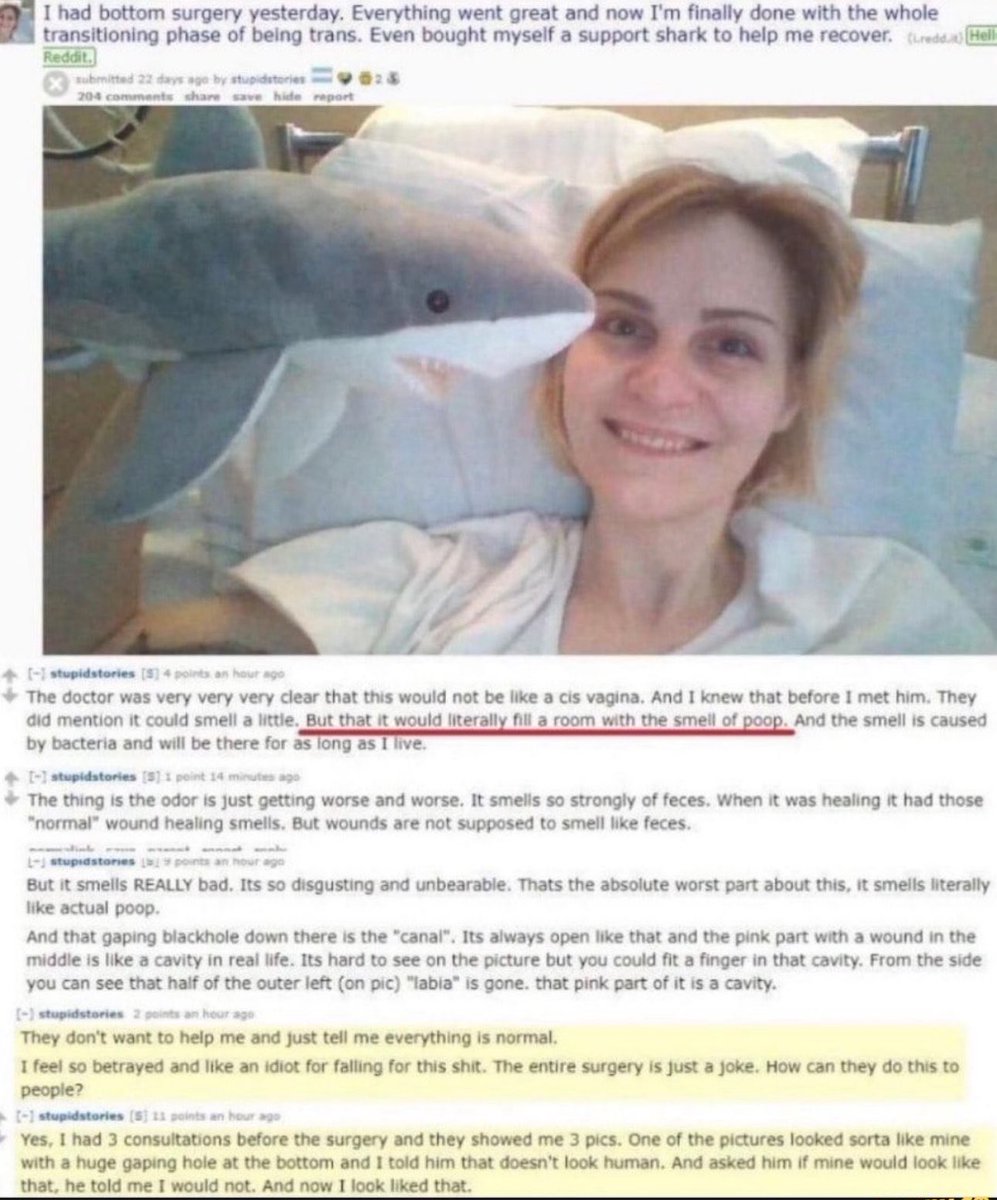 bambisoull's tweet photo. Oh you mean the other ones that have an open surgery wound, that smells like literal death and feces? https://t.co/bLicmhnh6e