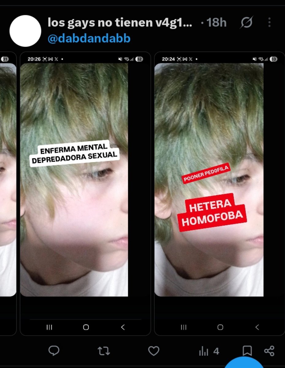 ddyered's tweet photo. Me incómoda saber que hay una cuenta transfobica que subio una ft mia diciendo q soy una depredadora s3xu4l y pdf, solo x ser trans https://t.co/emNHKPWUZg