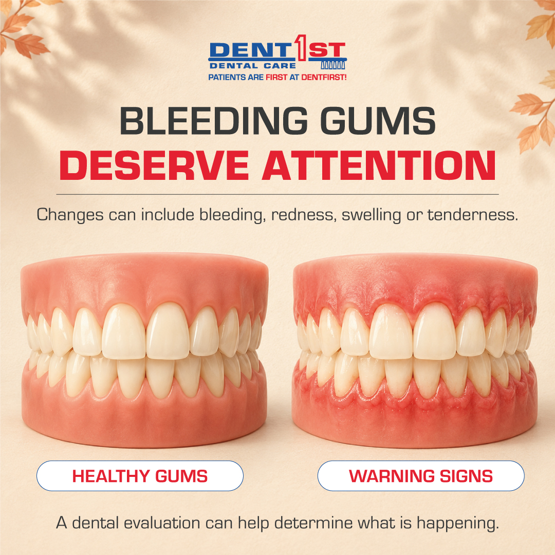DentFirst's tweet photo. Bleeding, tender, red or swollen gums are worth discussing with your dental team.  Schedule an evaluation with DentFirst. #GumHealth #DentFirst https://t.co/CmGcn2VyBY