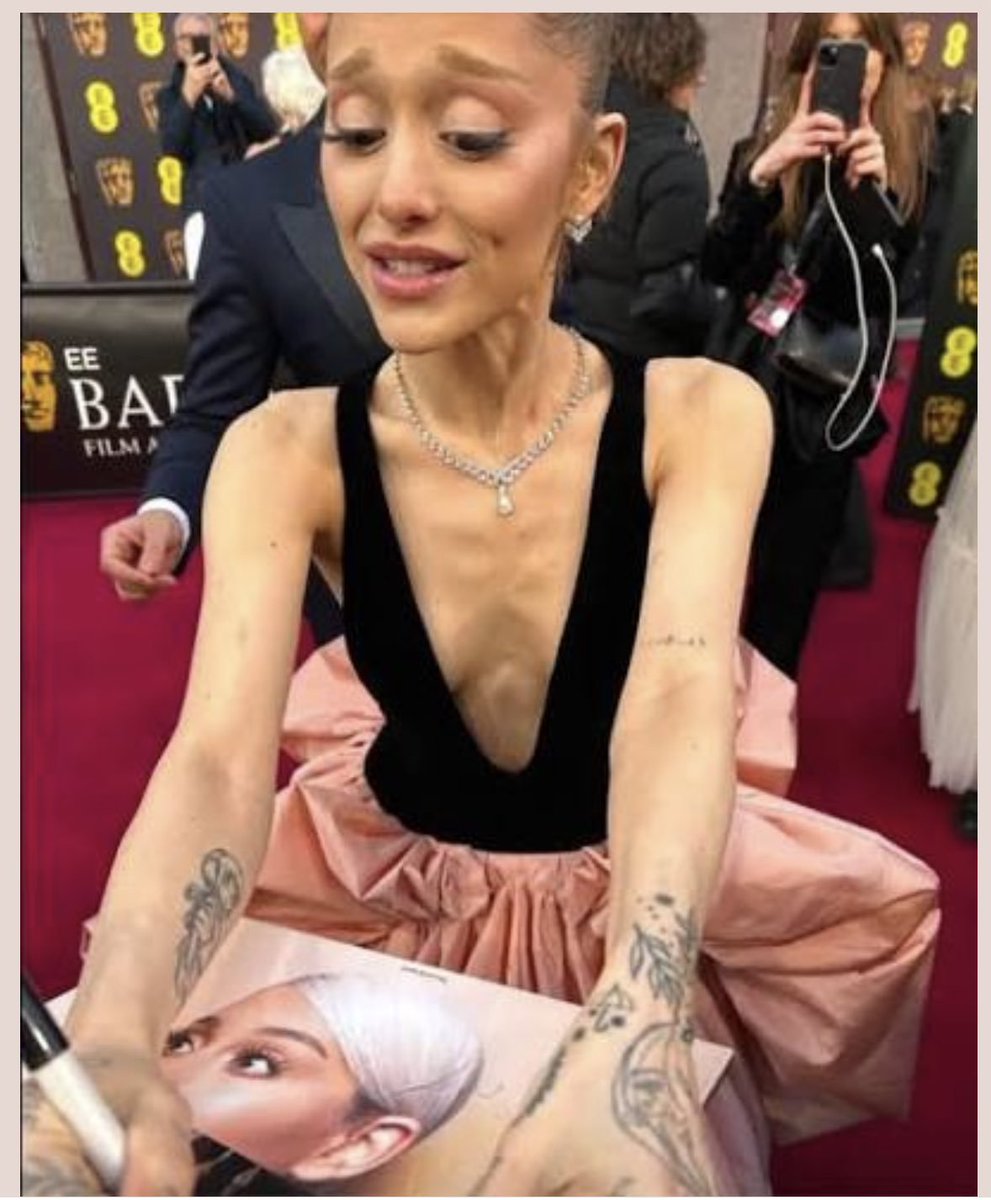 ADDICHELLA's tweet photo. @ONIKATANYAFLOP @sameoldpuss @americanreqiuem need someone to abu$e this bag of skeleton so bad. just one needle away https://t.co/Dw8Epkne1G