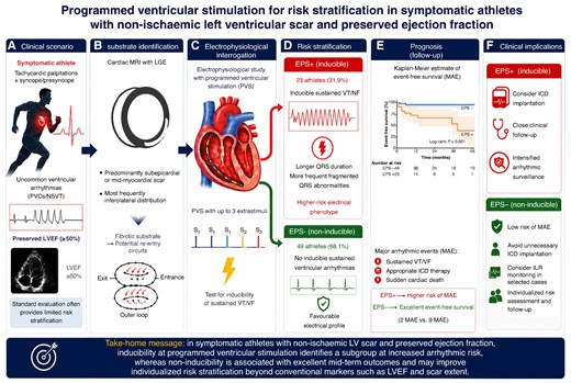 EuropaceEiC's tweet photo. #Europace #epepps
Programmed ventricular stimulation for risk stratification in athletes with nonischemic left ventricular scar and preserved LVEF
🔗 https://t.co/pqo9UnsIpz
@GiulioConteMD @FraSantoroMD @marcovitoloMD @AndyZhangMD @Dominik_Linz @DavideMei93 @LuigiDiBiaseMD https://t.co/NqPsuMzOE1
