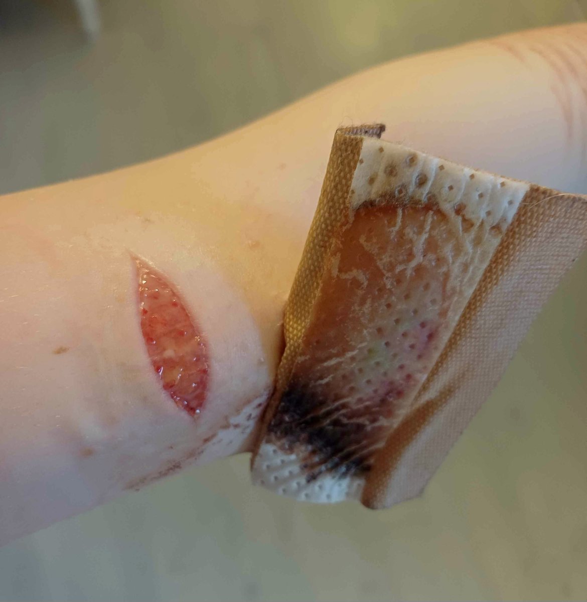 pukodollyy's tweet photo. Healing a few days in
.
.
#shedtwt (all fake sfx makeup) https://t.co/vWdKCCTJwW