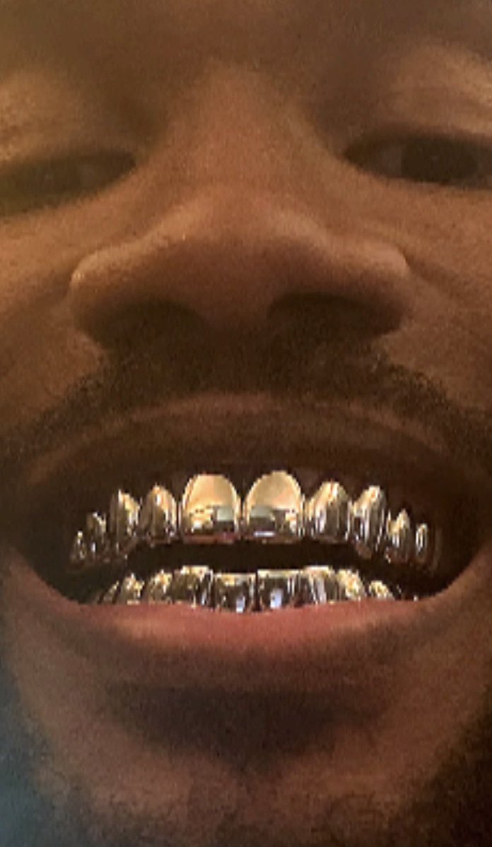 Kurrco's tweet photo. Frank Ocean shows off a head tattoo he almost got 👀

"I bitched out" https://t.co/9ZxMqeTfpC