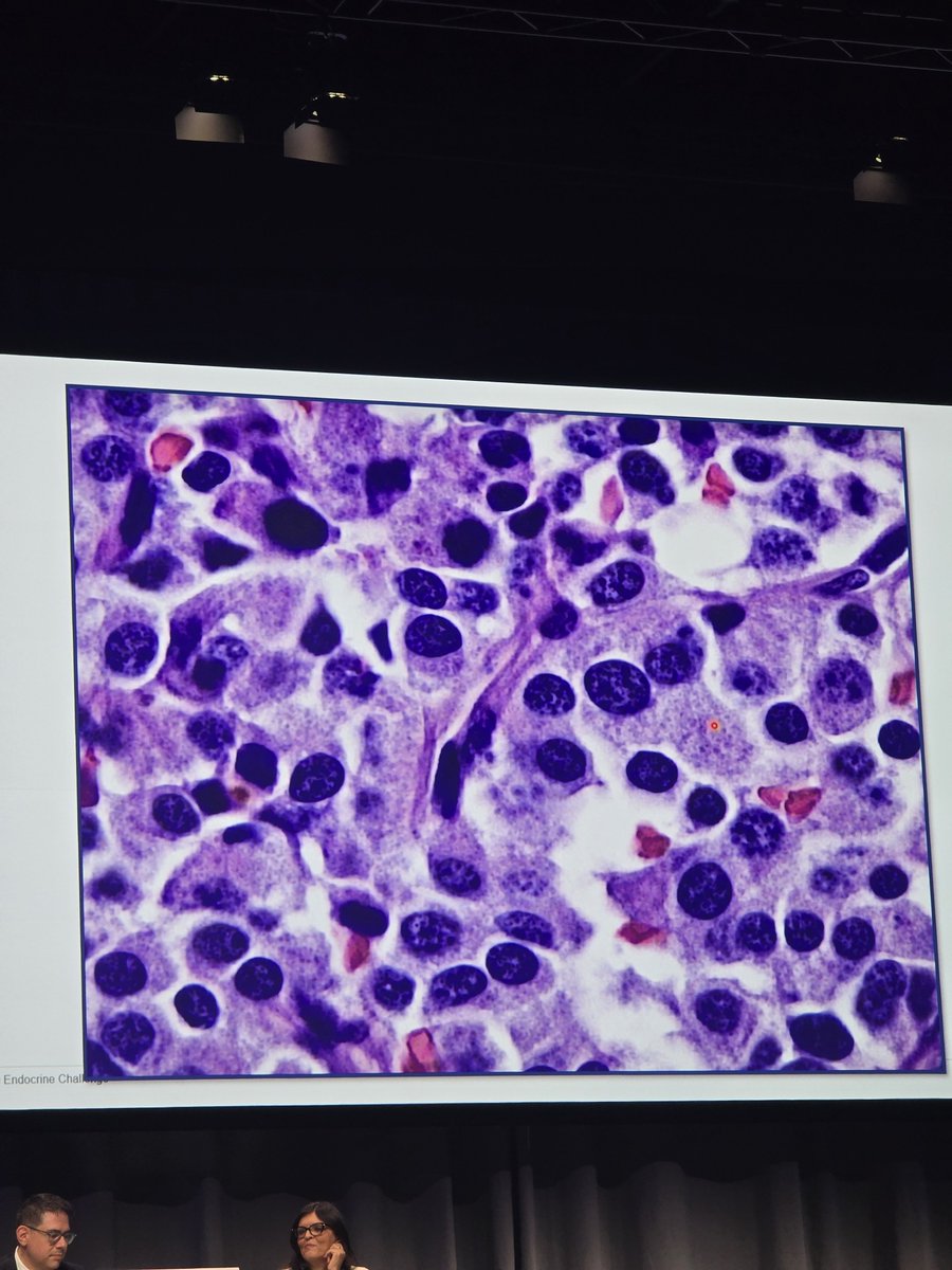 MolesSilvia's tweet photo. Some challenging (and very beautiful) endocrine cases at #ESPCongress Learning from the best! https://t.co/1QlbeGHTKc