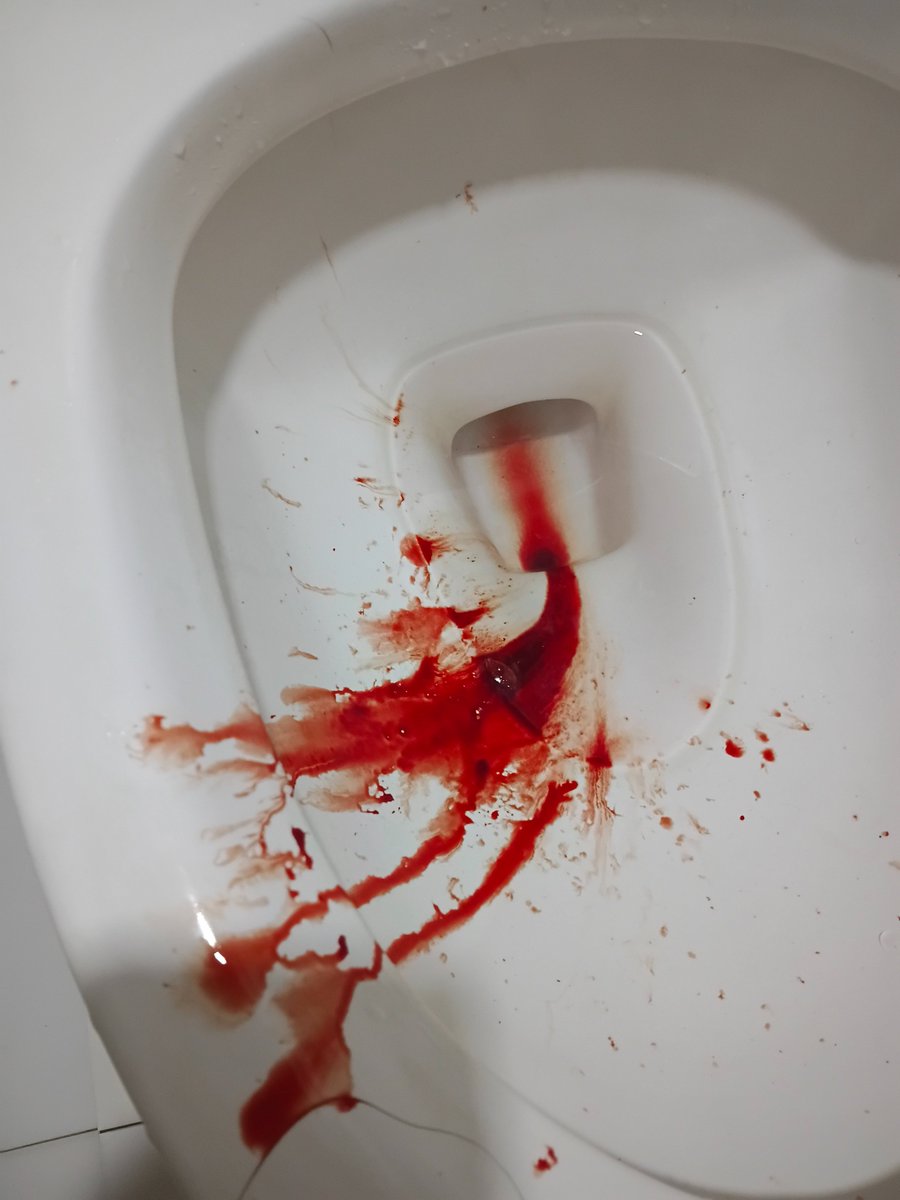skipdaformality's tweet photo. Urk.. https://t.co/1lYhx6v1Oc