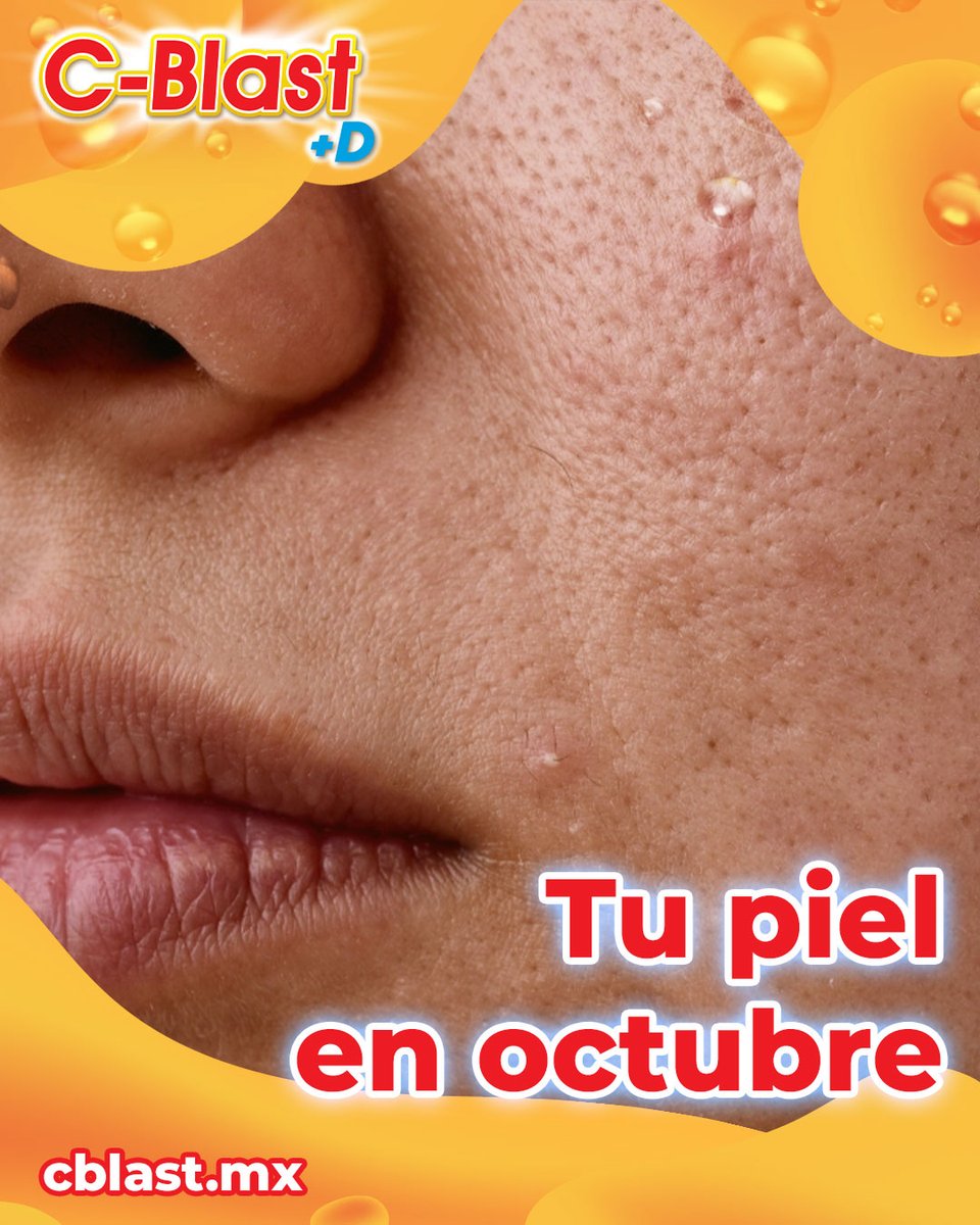 c_blastmx's tweet photo. Octubre es el mes en que la piel más se resiente del cambio de estación. 🍂✨

La vitamina C trabaja para ayudarla.

C-Blast+D: nutrición de piel desde adentro.
3 cajas por $180 → https://t.co/yGYJwhkiPU 🇲🇽

#vitaminaC #suplementoalimenticio #salud #cblast https://t.co/Wx7fzetCrL