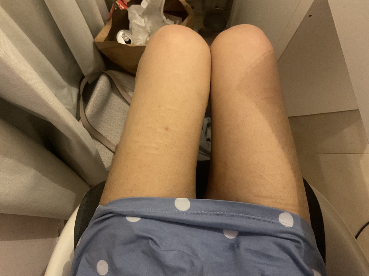 yukiisfine's tweet photo. before and after, don’t mind my stomach peaking https://t.co/EUGvi2ZhHL