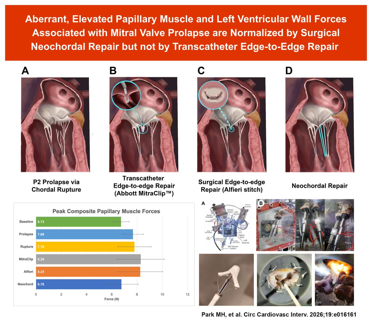 CircIntv's tweet photo. Aberrant, Elevated Papillary Muscle &amp; LV Wall Forces Associated with Mitral Valve Prolapse are Normalized by Surgical Neochordal Repair but not by Transcatheter Edge-to-Edge Repair @AlexanderReedMD https://t.co/ZTVGXdadfY https://t.co/l6swvpR7tP
