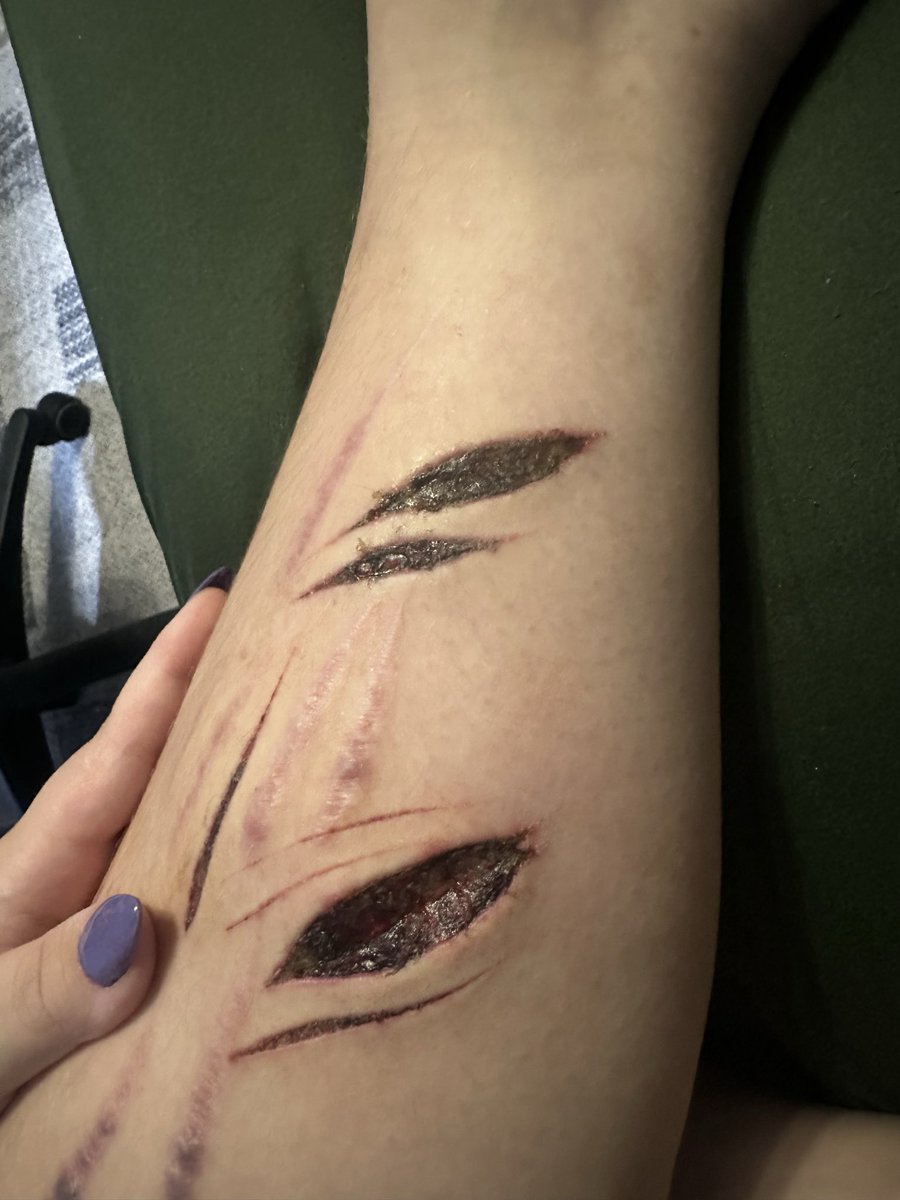 aryixiee's tweet photo. FFFUKIN HATE BEANS AND THEIR ANNOYING HEALING PROCESS + healing check on the big thigh cvt! will reupload the og fresh pic of dat one soon🤔

!! THIS IS MY SFX WORK, NOT REAL ITS MAKEUP !!
#shrtwt #slittwt #sfxtwt #moothunt #988twt https://t.co/nQaKa35xVW