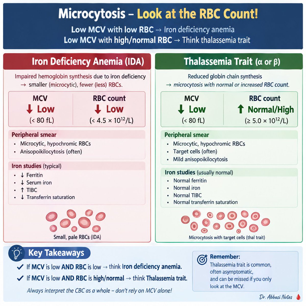 AbbasiMuqtadir's tweet photo. I cannot stress more on this one single image. Every physician should emboss in their mind. You ll pick a lot of undiagnosed thal minors.

#x #medx #thal #cbc #ida https://t.co/4EMYlToc23