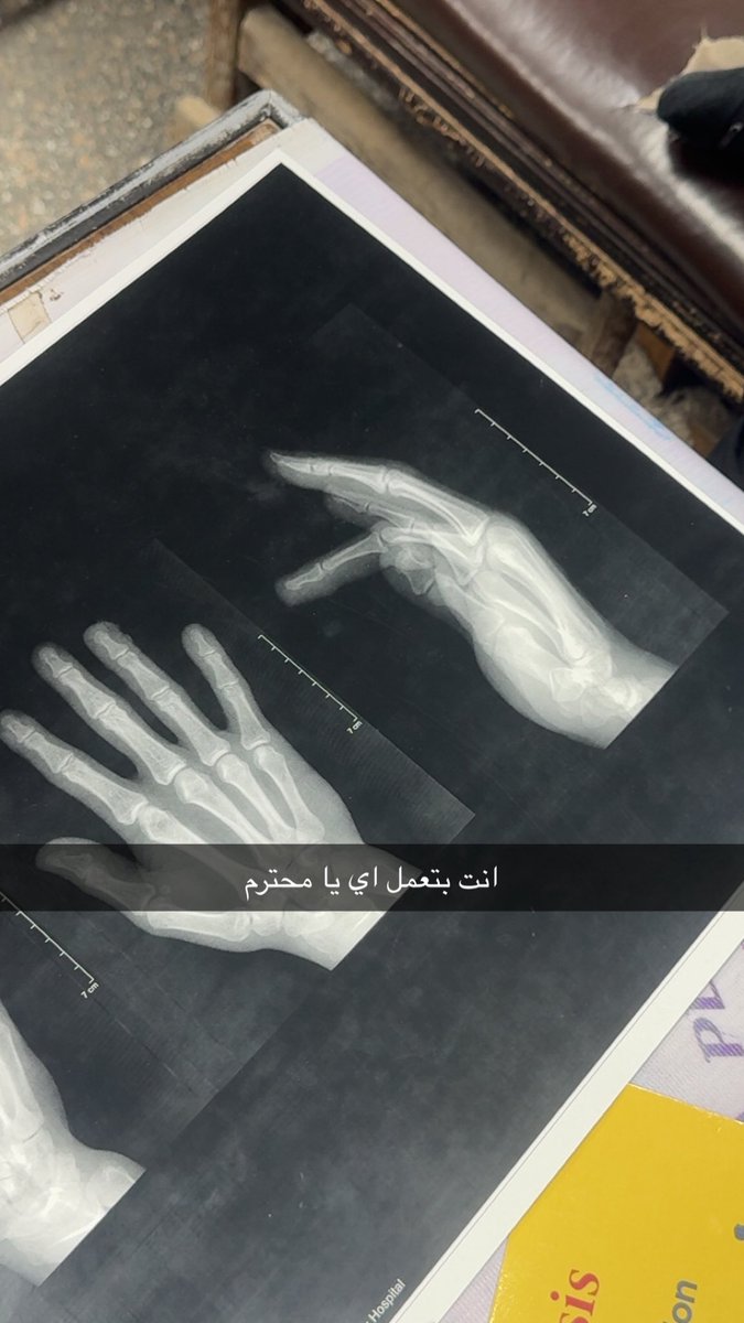 Moniamin55's tweet photo. انا هسيب الطب https://t.co/EVOjvcPCPa