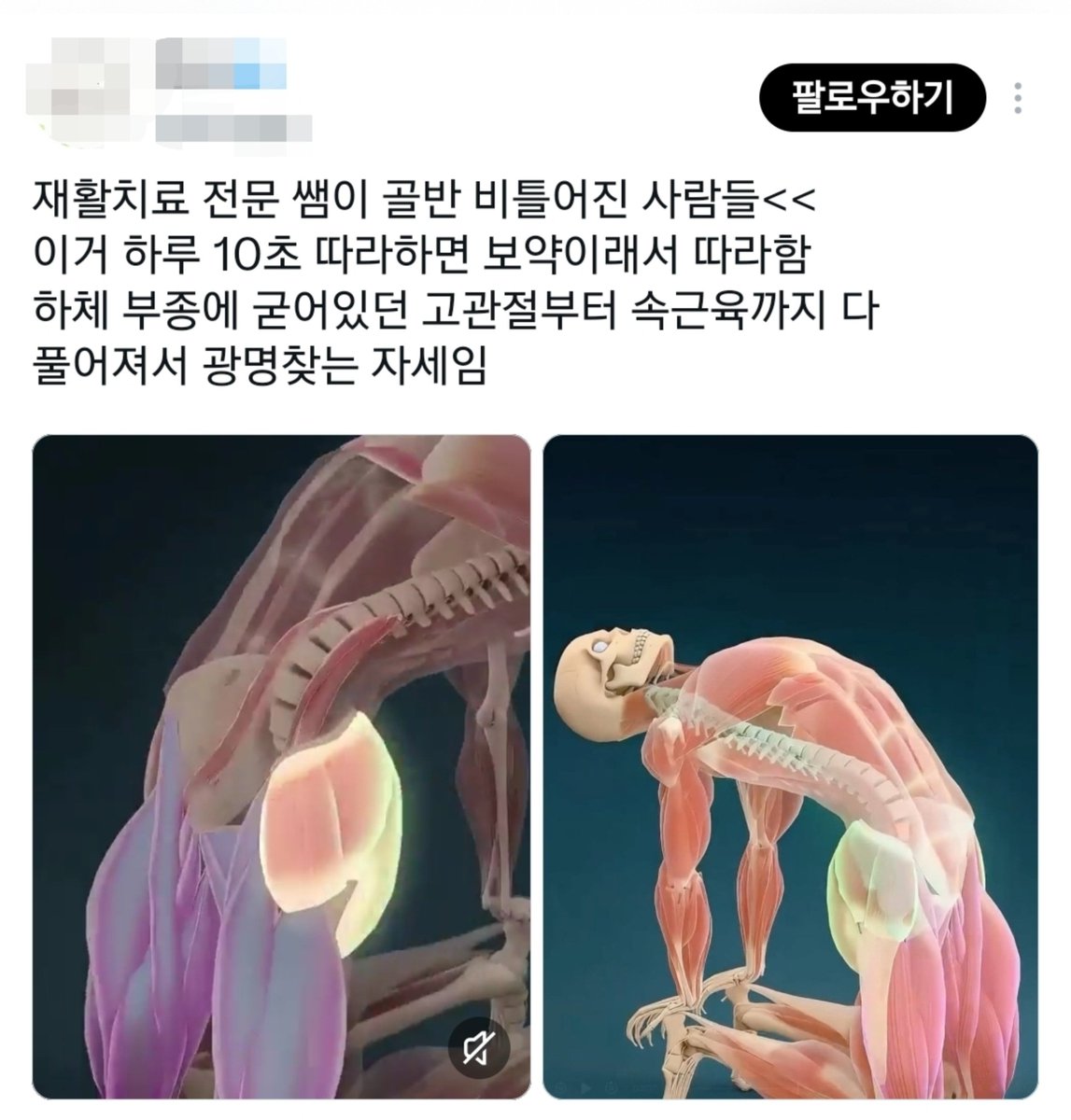 goodssalhapssal's tweet photo. 본인이 인지할 정도로 골반이 비틀려있으면 이런 것을 하면 안됩니다. 그리고 같은 동작이라도 옆에서 지켜보고 위험상황시 바로 중단해 줄 수 있는 지도자가 있는것과 인터넷 보고 무작정 안 해본 동작을 혼자 따라해보기랑은 천지차이고요. https://t.co/XdCQ2CeVSE