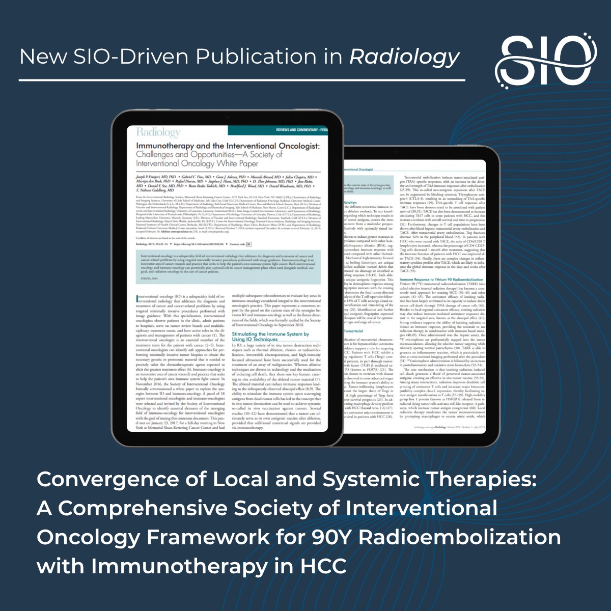 SIO_Central's tweet photo. "Immunotherapy and the Interventional Oncologist: Challenges and Opportunities — A Society of Interventional Oncology White Paper" reviews the evidence, clinical rationale, and future directions for combining Y-90 and immunotherapy in HCC. Read more: https://t.co/J6N8oyfm7G https://t.co/f972xXLrxN
