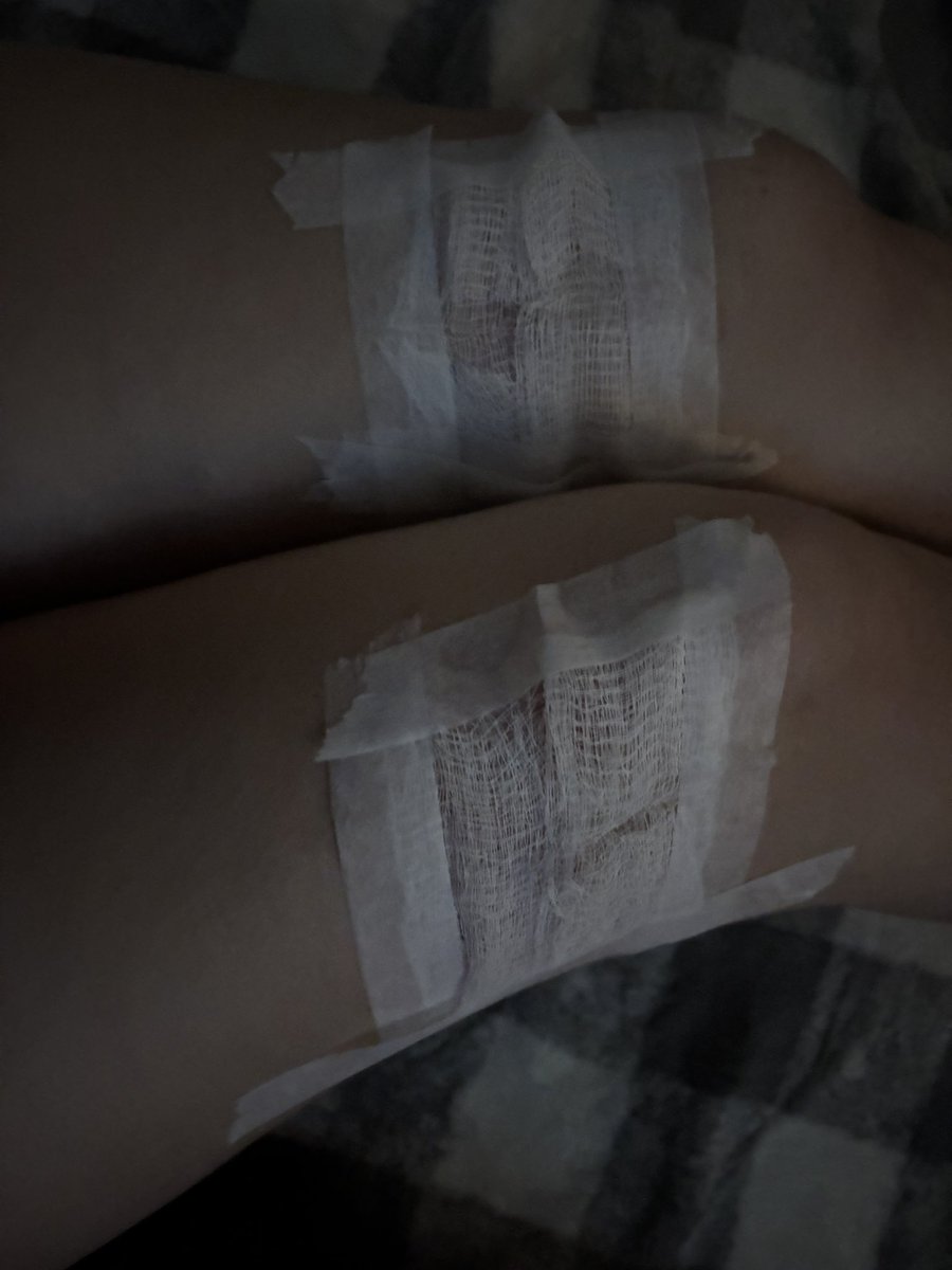 starvdvee's tweet photo. doctor bandaged up my 🫘 https://t.co/iPR4JIUyvc
