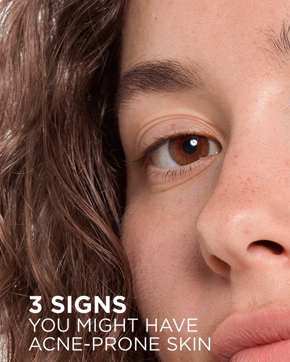 Bioderma_ID's tweet photo. Spots that keep coming back, marks that won't fade, skin that stays red and reactive.These are signs your skin needs more than a spot treatment. It needs a routine that works at the root.The Sébium range is built for exactly that. Cleanse, control, and prevent, all in three steps https://t.co/TpFJjackPf