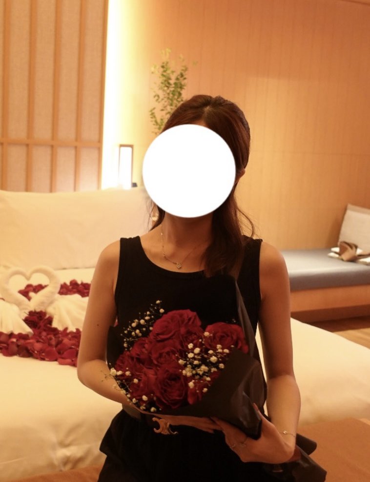_____xxkrm's tweet photo. これめちゃ分かる、わしは1秒でも細くなりたかったからやった🤣
脂肪吸引から3年経過したけどボコ付き色ムラ弛みなく傷跡も綺麗にしてくれて執刀医には大感謝。ｶﾞﾁ職人の先生だから激安系ではないけど良心的な金額でアップセルもないし信頼してるクリニック。いつか脂肪豊胸もここでやる予定 https://t.co/8ZgQ2lq3Yk