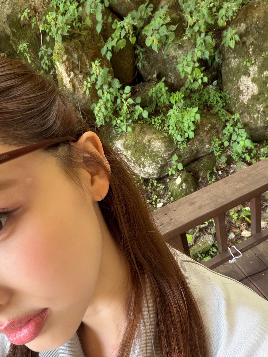 godmitzu's tweet photo. Nayeon showing off the mosquito bites she got filming outdoors with TWICE yesterday 😭 https://t.co/TKoAywMioA