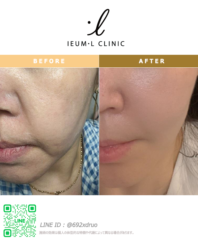 ieumlclinic_jp tweet picture