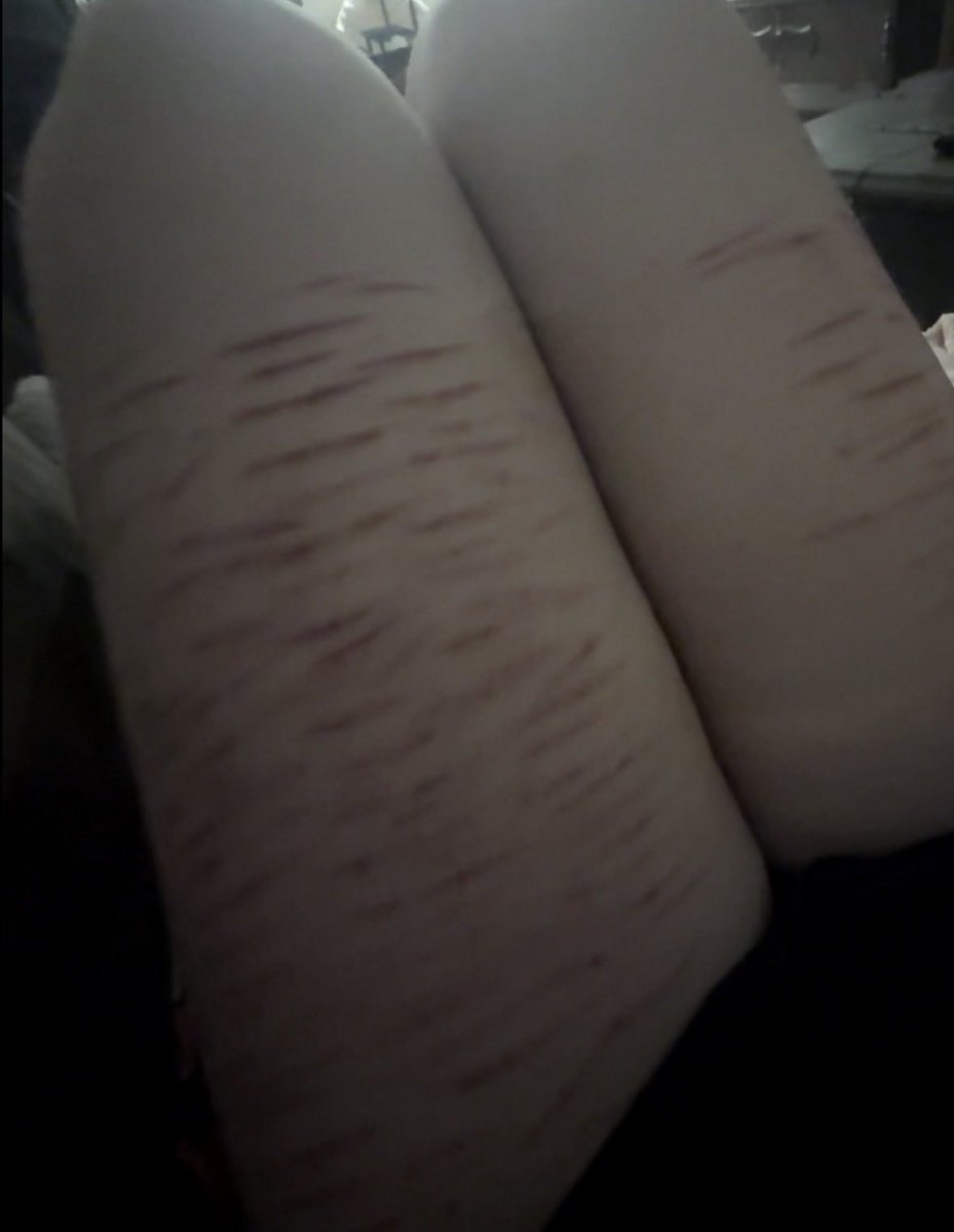 nyatardd's tweet photo. sfx makeup um. check out this really cool makeup i did. sfx sfx sfx . or sometjing. anyways . i might be leaving twitter for 7-12 days to go somewhere im sure u can guess where . dont miss me too much^-^ https://t.co/Mo7NhL7YtV
