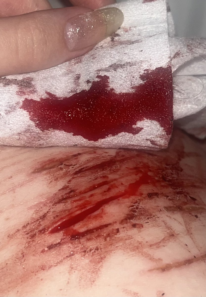 peitoisnthungry's tweet photo. I don’t even feel like painting with it this time

why it bleeding so quickly it’s not even deep vro

#shhtwt 

sfx makeup that’s ai enhanced for realism https://t.co/wR2iPVyzyW