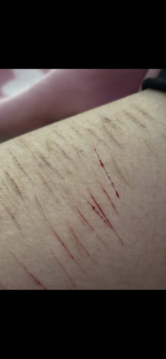 sowhatimalrdead's tweet photo. I USED GLUE sfx makeup so pretty https://t.co/qQXzDMErZ5