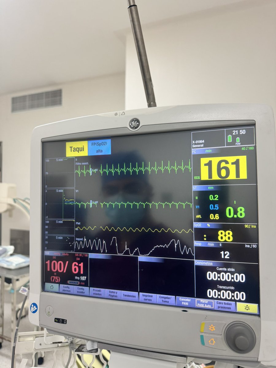 jjtorresh's tweet photo. Choque hipovolémico hemorrágico por trauma esplénico y renal.

Colapso hemodinámico posterior a la inducción anestésica para laparotomía.

PAM 75 → 38 mmHg (-49%) https://t.co/cLDzee6pJP