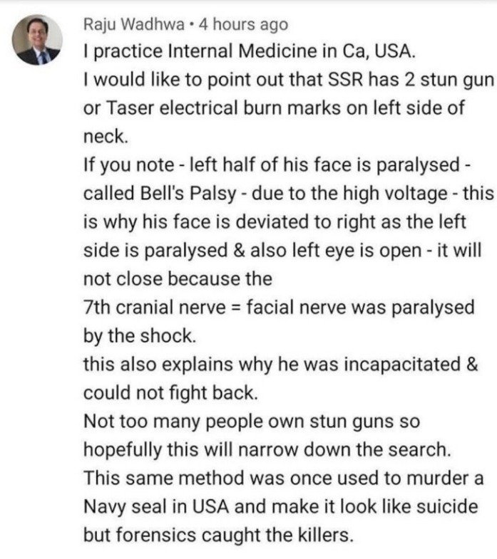 MeenaDasNarayan's tweet photo. in #SSR case @republic did a sting operation which revealed #StunGunInjuries on #SSR s body, we had tweeted the response of Dr Raju Wadhwa from USA where he suspected this and other details.. why did the @CBI dismiss this? Now the truth is  out loud an clear from Post Mortem team https://t.co/3cgvkrDObE