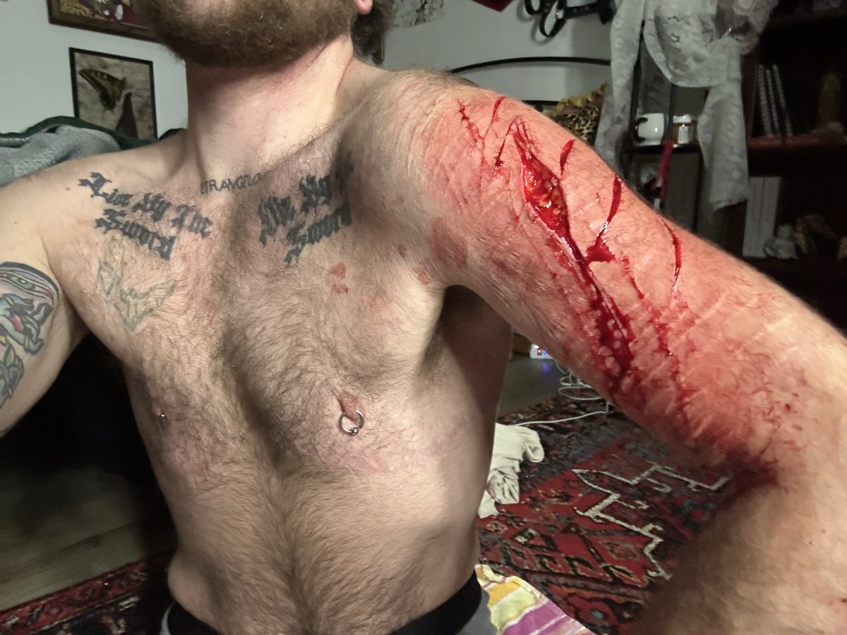 futuriskey's tweet photo. I’ve been trying to control the bleeding for like 15 mins!! 😍 MASSIVE TW   here that is relating to sh and I am 22 years old how sad this is not good and I refuse to be apart of shedtwt hoping I can relax a bit dear god am I disappointed in myself idk what happened https://t.co/N9V8uEVCRg
