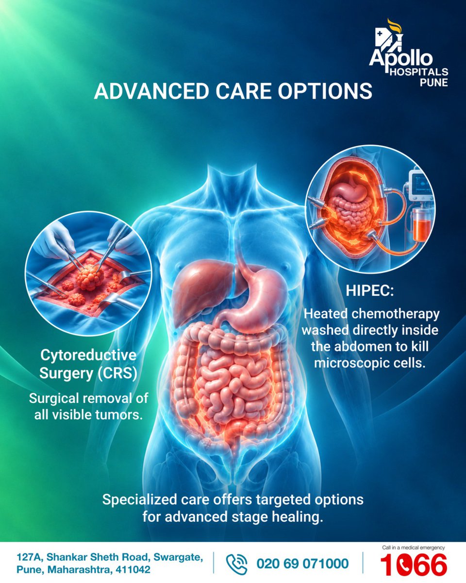 ApolloPune's tweet photo. Understanding Peritoneal Surface Malignancy (PSM): Recognizing early signs like bloating and ascites is key to timely intervention with advanced treatments like CRS &amp; HIPEC.

Something big and specialized is coming your way, Stay tuned!

#CancerAwareness #Oncology  #ApolloPune https://t.co/xU9o9YPl6t