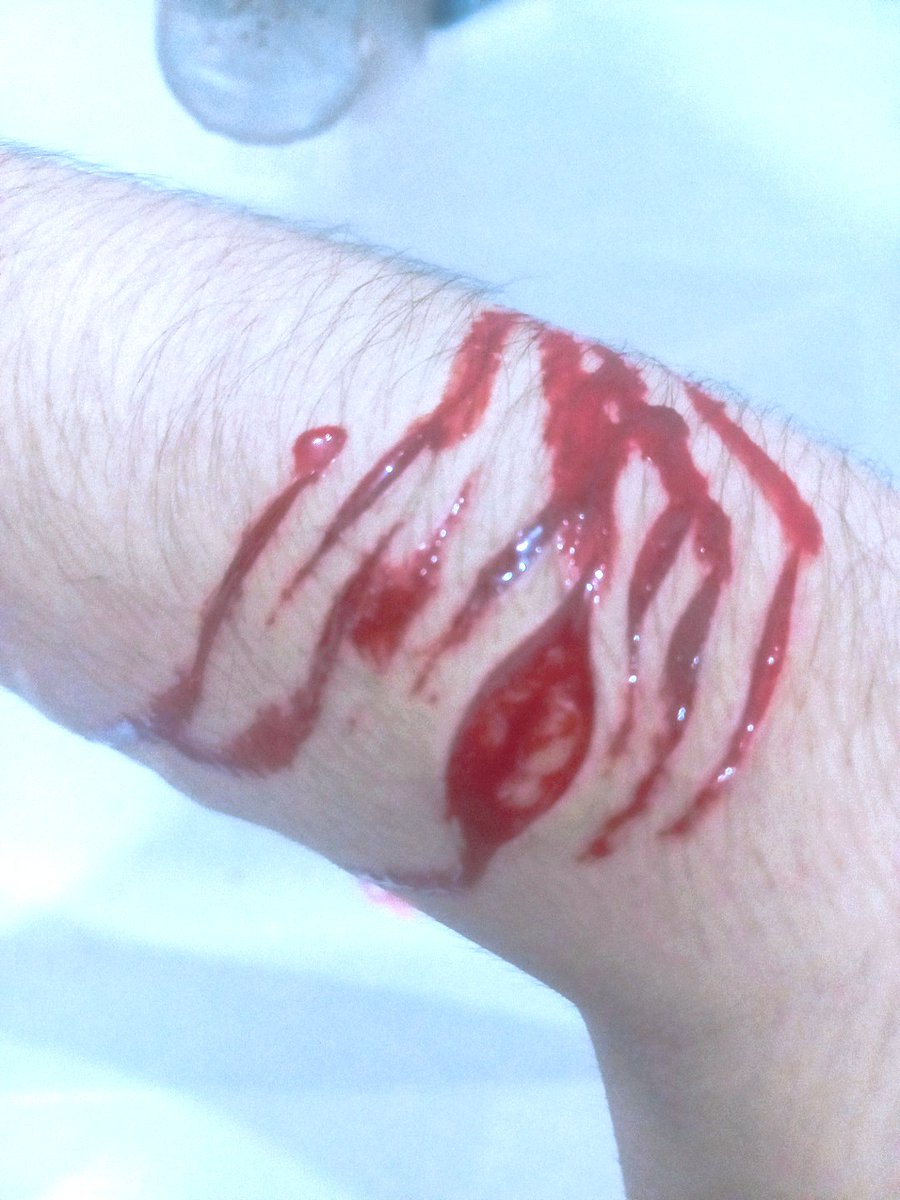 PersDeath's tweet photo. Guess who got new blades (≡^∇^≡)
Some kind of bean & styros :P
Now I'm kinda mad that I don't bleed, but ig it's bc I also don't eat(?
ALL FAKE, SFX PRACTICE
────
#shredtwt #shrtwt #shwt #sharm #cuttwt #ouchietwt #988twt https://t.co/ElJYfStyqH