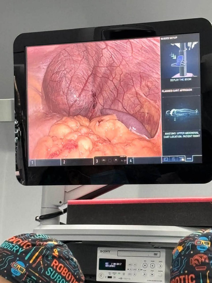 drvivekbindal's tweet photo. #Honoured to be #invited as #ChiefOperatingFaculty at #IGMCShimla’s #RoboticSurgeryWorkshop on Sept 12. Demonstrated 3 live #robotichernia cases with Dr Deepak Kumar. Thanks to Prof. Puneet Mahajan and his team.

#RoboticSurgery #DrVivekBindal https://t.co/2WKg1gz8dm