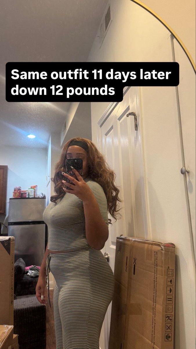 LookAtLollyy's tweet photo. My fibords surgery was 11 days ago I already lost 12 pounds 🙏 https://t.co/MyvSXmF8Zd